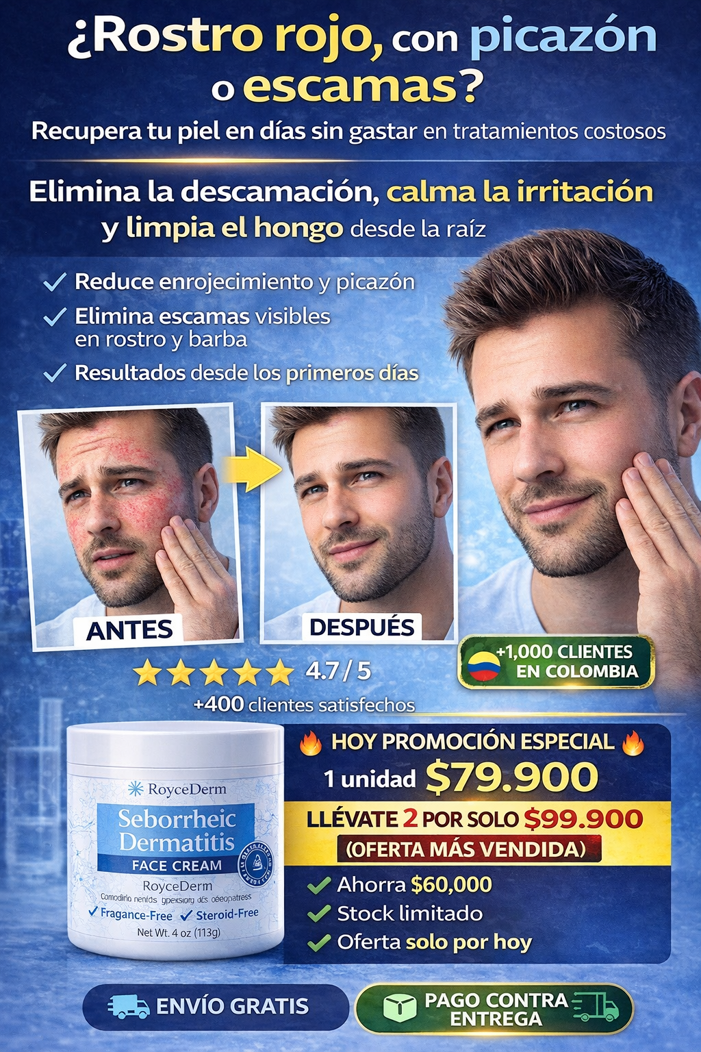 Roycederm Seborrheic Dermatitis BioCalm Skin Repair