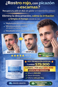 Roycederm Seborrheic Dermatitis BioCalm Skin Repair